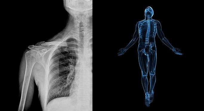 Radiografia Intelligenza Artificiale