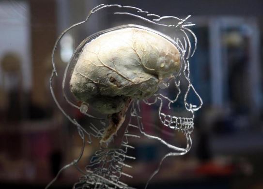cervello umano coltivato in laboratorio