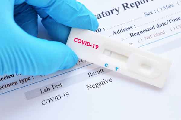 Test coronavirus Covid-19 saliva