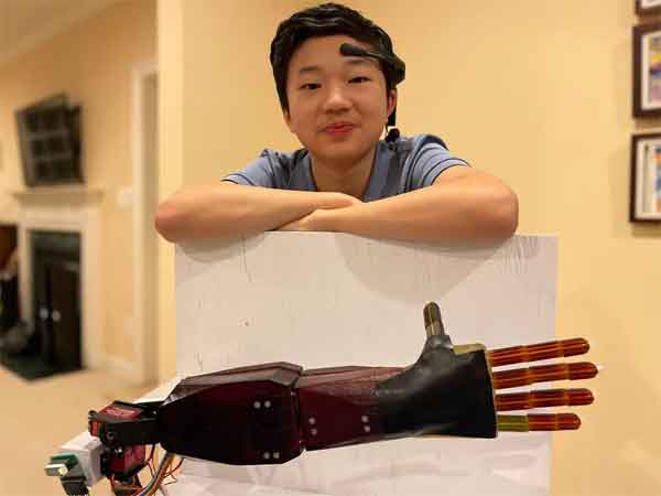 Benjamin Choi braccio protesico